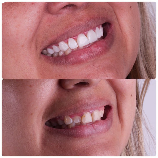 Foto 2 de Bemtô Clínica Odontológica