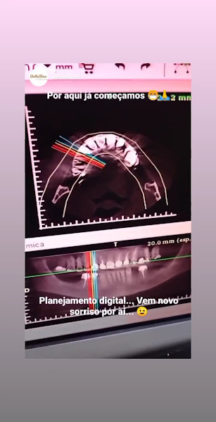 Foto 3 de Ben'to Blanc Odontologia Premium