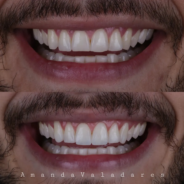 Foto 2 de Benício & Valadares Odontologia especializada