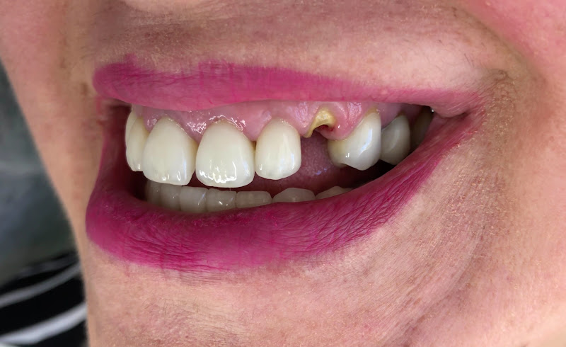 Foto 4 de Benne Odonto Clinica Odontológica Ltda