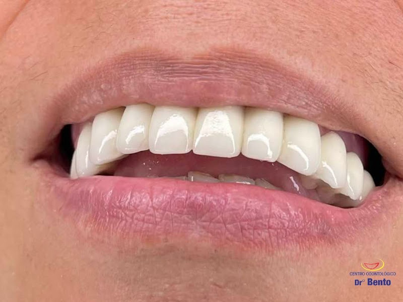 Foto 8 de Bento Odontologia Especializada