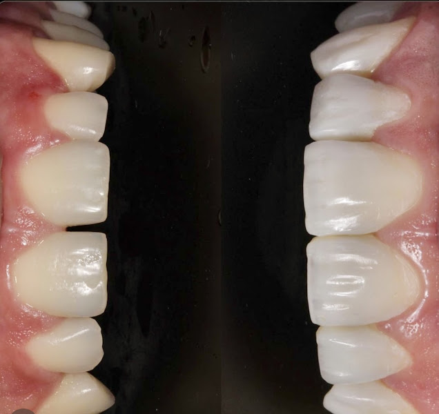 Foto 3 de Bernardo Maia Odontologia Avançada