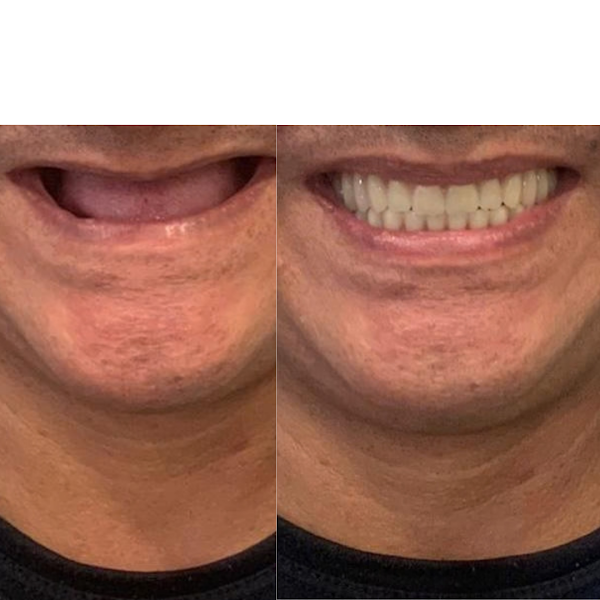 Foto 3 de Beta Odontologia Clínica Odontológica | Dentista em Brasília - Implantes, Facetas e Clínico Geral