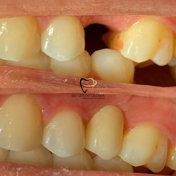 Foto 3 de BG Odontologia Consultório Odontológico