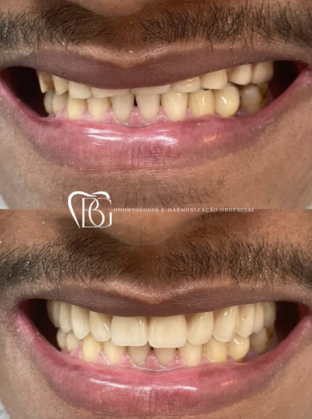 Foto 2 de BG Odontologia e Harmonização Orofacial