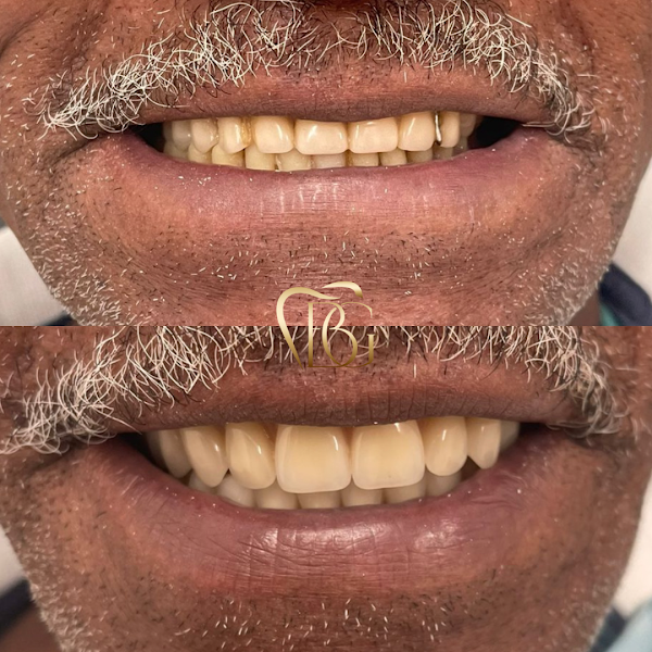 Foto 3 de BG Odontologia e Harmonização Orofacial