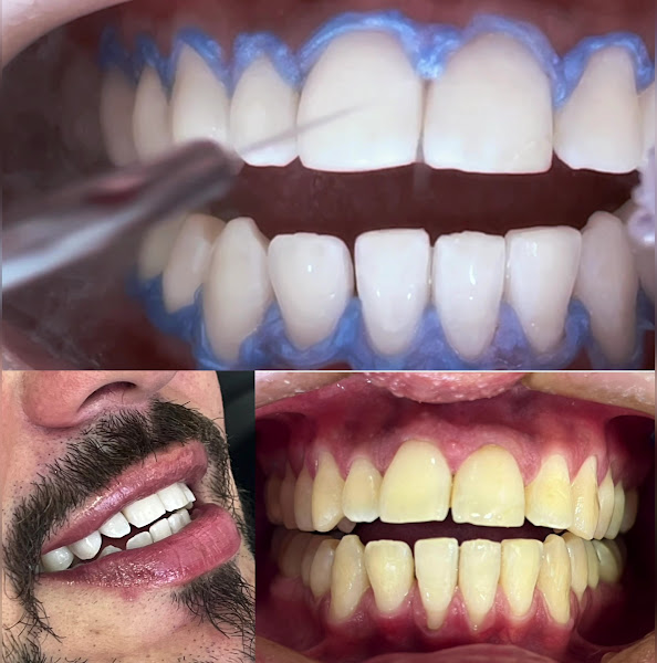 Foto 3 de BG Odontologia Oral e Estética