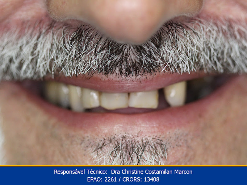 Foto 3 de Bhem+ Clinica Odontolológica Dentistas e Implantes Dentários em Canoas