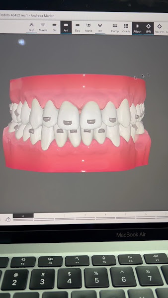 Foto 5 de Bhem+ Clinica Odontolológica Dentistas e Implantes Dentários em Canoas