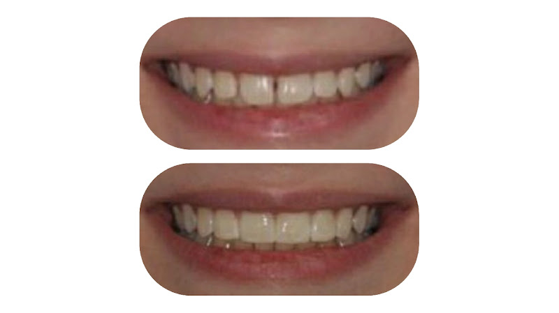 Foto 2 de Bianchi Odontologia - Clínica Odontológica em Santos