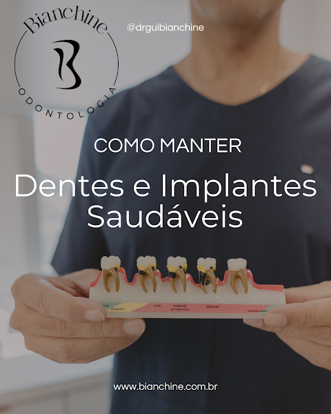 Foto 3 de Bianchine Odontologia I Implante Dentário Icaraí, Niterói - RJ