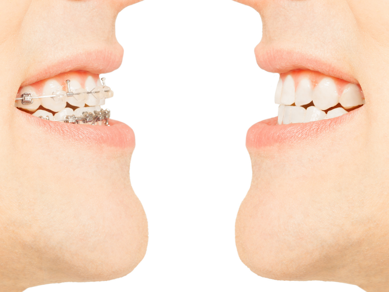 Foto 6 de Biasiferro Odontologia Integrada