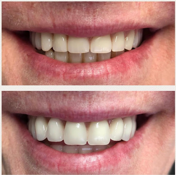 Foto 3 de Bibiana Stein ODONTOLOGIA - Prótese Dentária em Santa Cruz do Sul