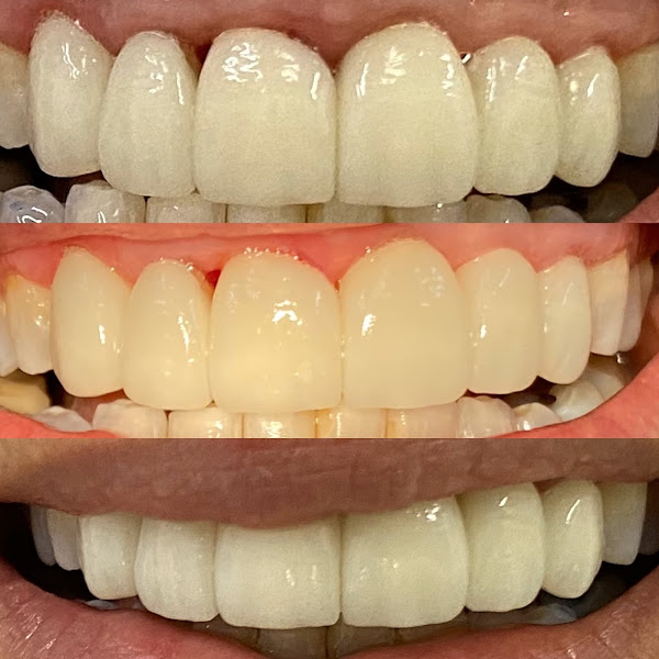 Foto 3 de bicudo - odontologia e estética