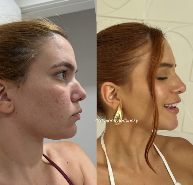 Foto 3 de Binsky Estética-Harmonização Facial