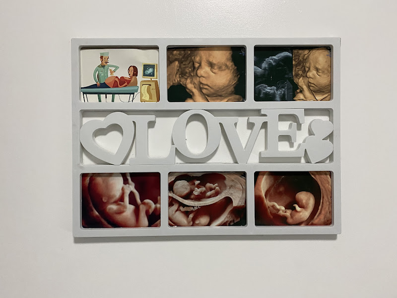 Foto 3 de Biodiagnostikus resultado de exames