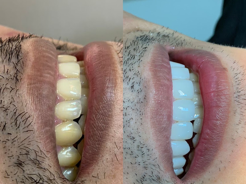 Foto 2 de Biodonto implantes