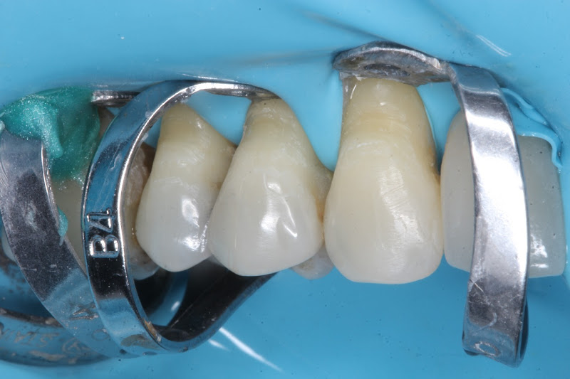 Foto 3 de BIOIMPLANTES | Dentista / Clínica Odontológica no Bessa, João Pessoa - PB