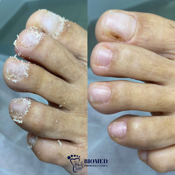 Foto 2 de Biomed Podologia Clínica