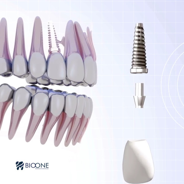 Foto 4 de Bioone Odontologia | Implante Dentário | Dentista Jundiaí