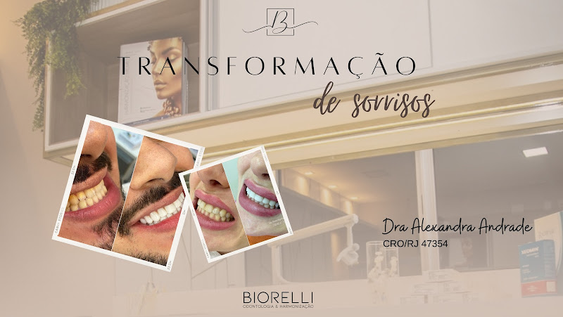 Foto 2 de Biorelli Odontologia - Dra. Alexandra Andrade - Dentista em Niterói - Consultório Odontológico - Facetas Niterói