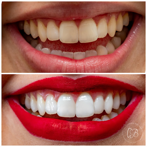 Foto 3 de Biscaro Odontologia Personalizada e Saúde Integrada