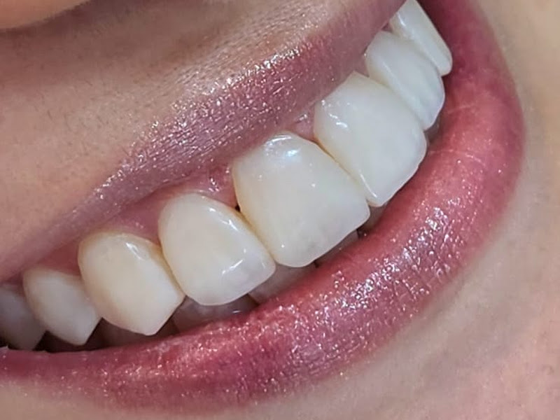 Foto 9 de Bispo Clinic | Dentista em Teresina - PI