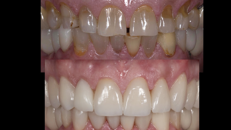Foto 3 de Bitencourt Odontologia