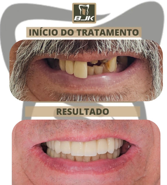 Foto 2 de BJK Odontologia Avançada