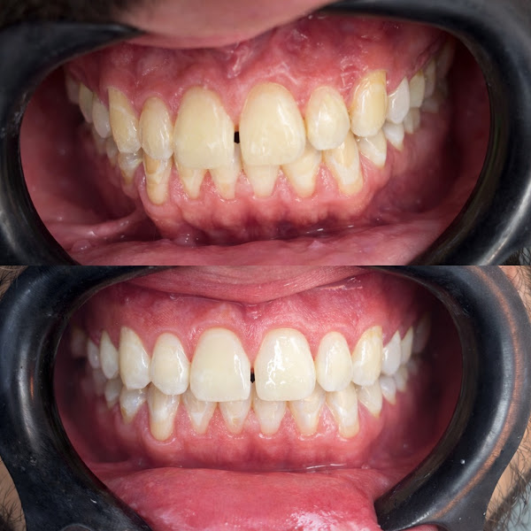 Foto 3 de BL Odontologia