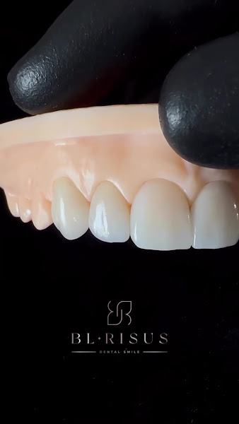 Foto 3 de BL Risus | Laboratório de Prótese Dentária