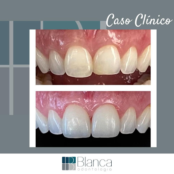 Foto 3 de Blanca Odontologia