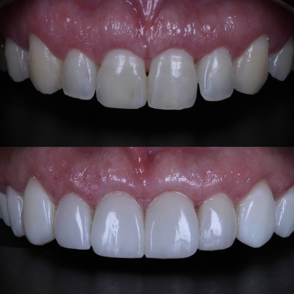 Foto 2 de Blanca Odontologia