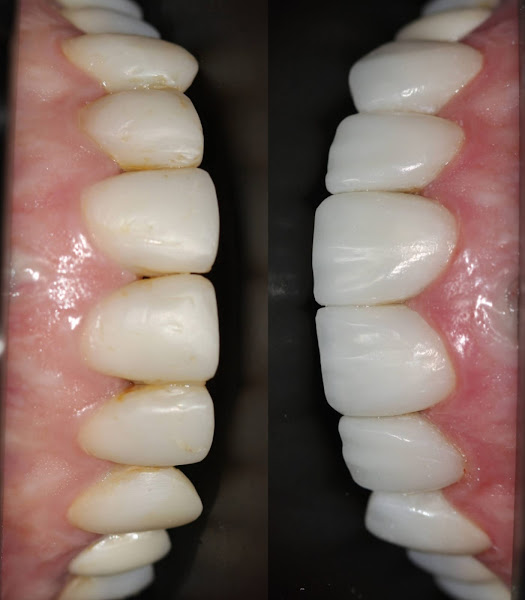 Foto 3 de Blanca Odontologia