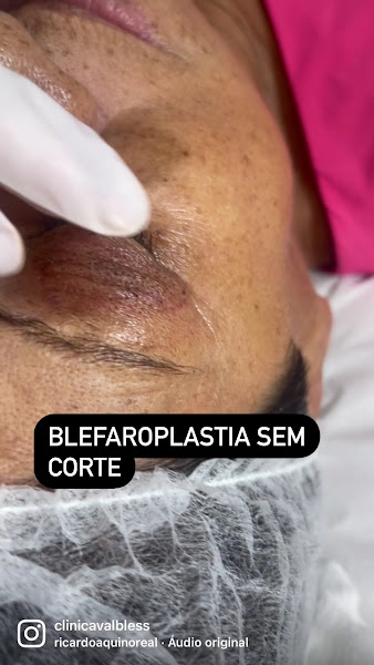 Foto 3 de Bless Clinica Valéria Soares