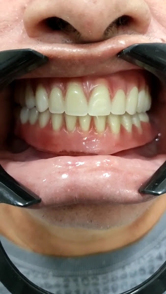 Foto 2 de BM odontologia | Dentista em Serra ES