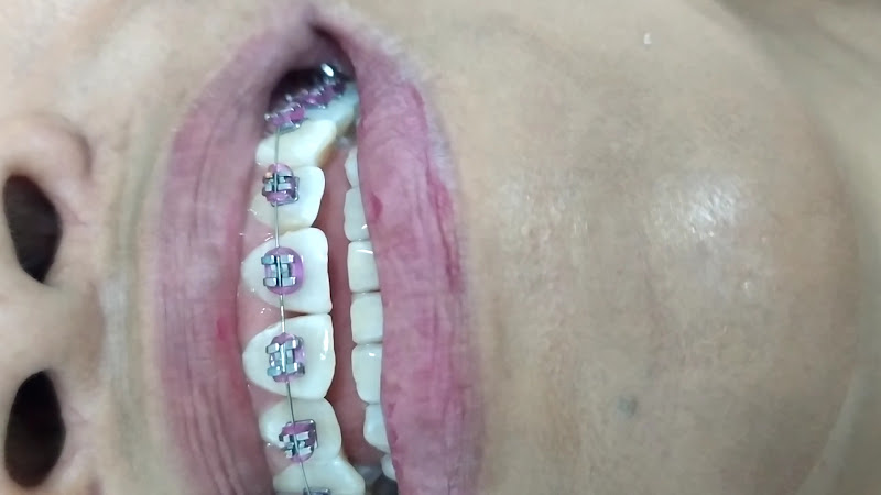 Foto 3 de BM odontologia | Dentista em Serra ES