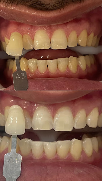 Foto 2 de Bohnenberger Odontologia e Bem-estar