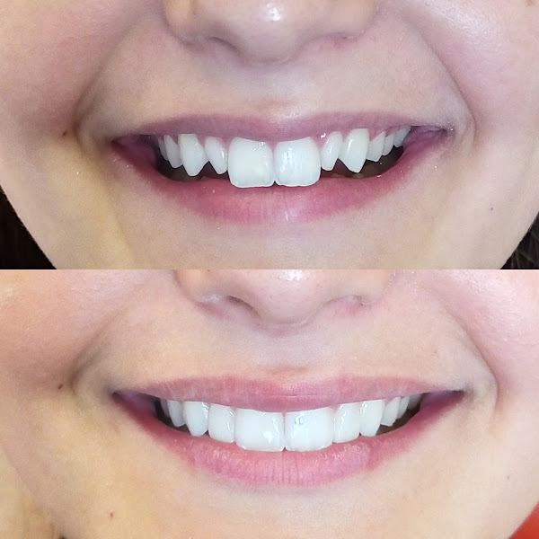 Foto 2 de Bonfanti Odontologia