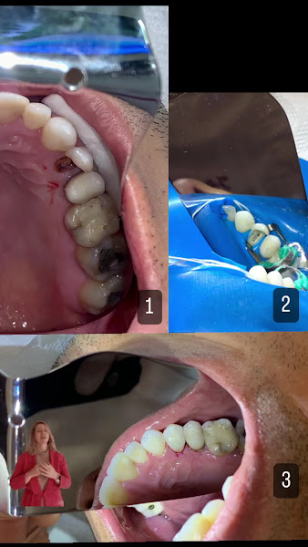 Foto 4 de Bonfanti Odontologia - Dentista em Curitiba/Batel