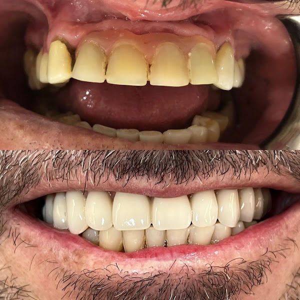 Foto 2 de Bonoclin Odontologia