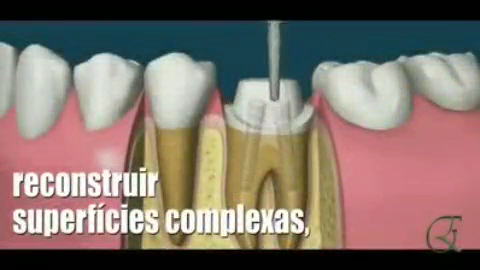 Foto 3 de Borborema Lucia, Drª Tratamento de Canal, com Microscópio Operatório