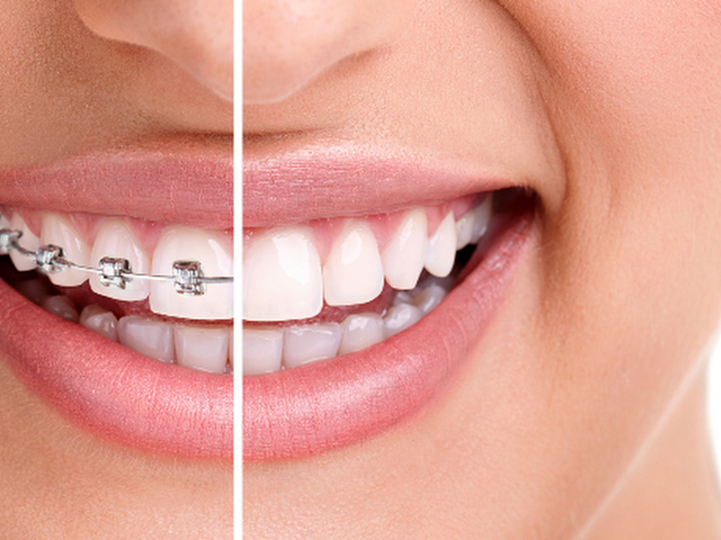 Foto 3 de Borel Odontologia