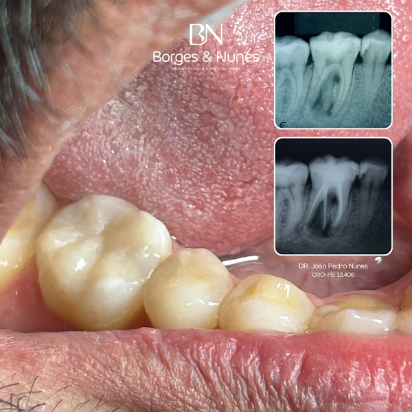 Foto 3 de Borges e Nunes Odontologia Especializada