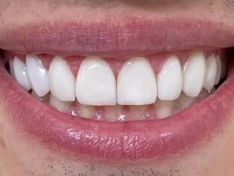 Foto de Bosco Carvalho