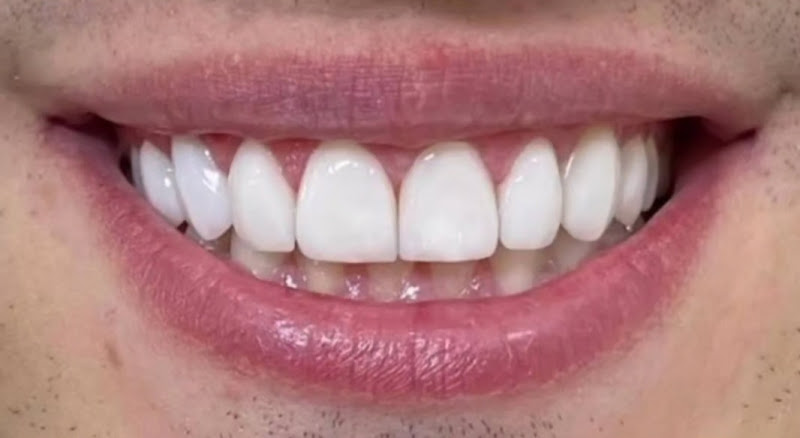 Foto 2 de Bosco Carvalho