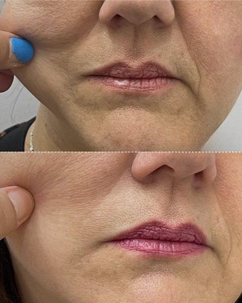 Foto 3 de Botocenter Caruaru: Clínica de Estética, Caruaru PE