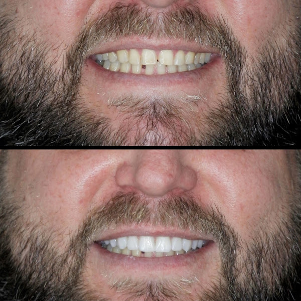 Foto 3 de Botton Odontologia