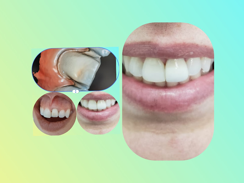 Foto 4 de Bozzini Odontologia