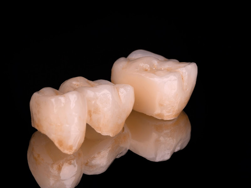 Foto de Bradaschia.Lab | Laboratório de Prótese Dentária Digital e Híbrido em Goiânia